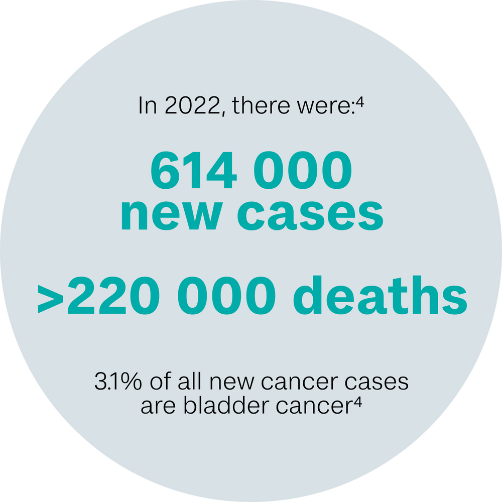 Diagram of diagnosis, treatment and follow-up for bladder cancer